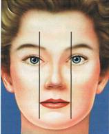 Análisis facial · Instituto de cirugía estética Dr. Serra Renom